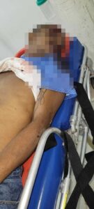 Fallecido en accidente