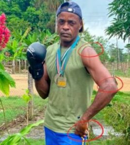 El deportista sufrió un ataque a machete en el mejor momento de su carrera deportiva. // CORTESÍA.