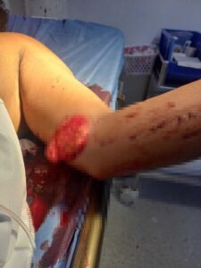 Caso de agresión contra la atleta Dukina Freytters Rodríguez